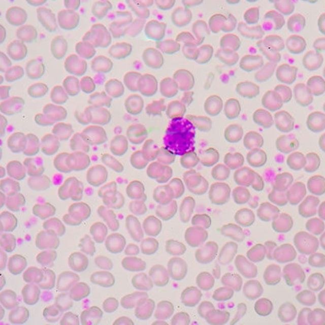 Cytopathology at Sparsha Diagnostics