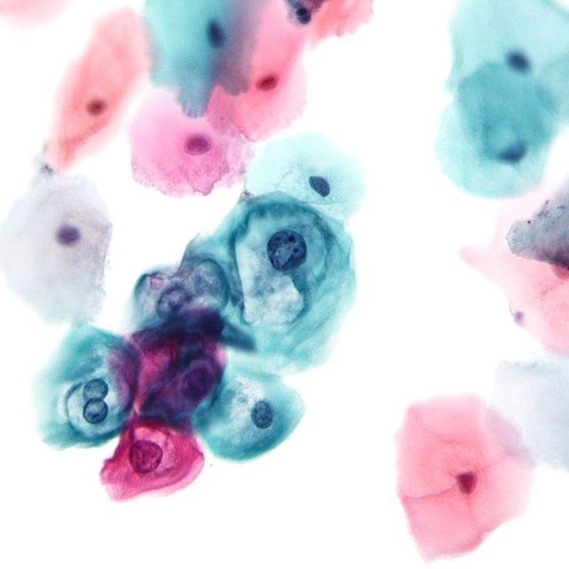 Histopathology at Sparsha Diagnostics